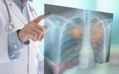 Fiese Fasern – Die unterschätzte Gefahr in Windkraftrotorblättern